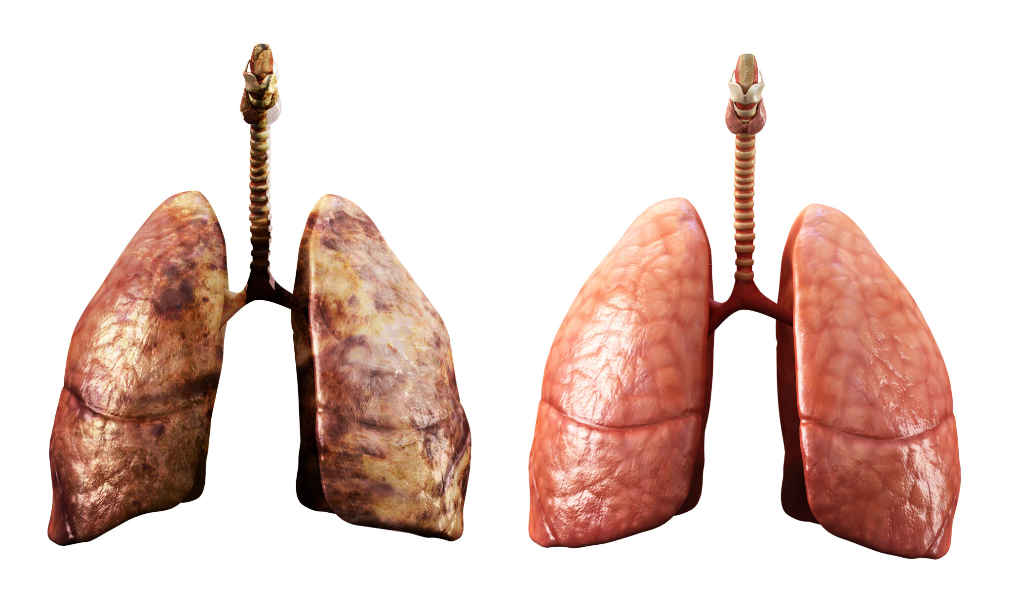 healthy and rotten lungs - Compliance Standard Group